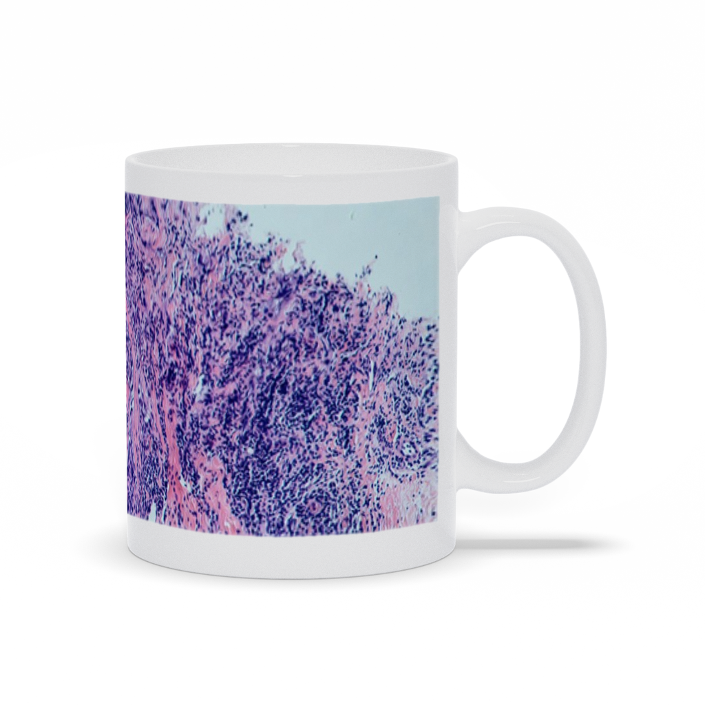 "BRCA1" Mug